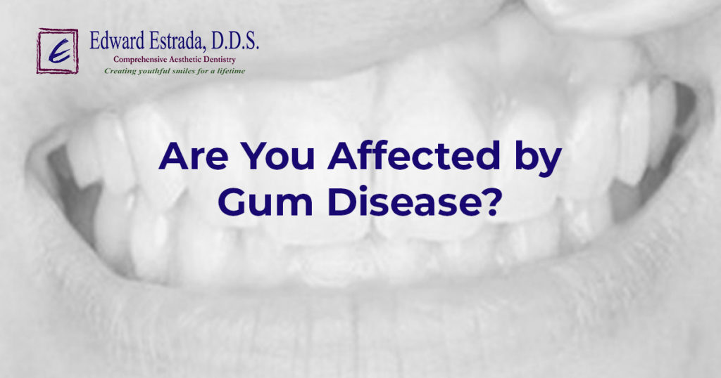 Are You Affected By Gum Disease? - Edward Estrada, D.D.S.