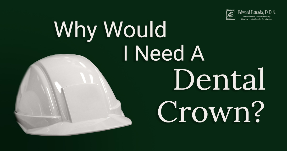 Dental Crowns - Edward Estrada, DDS